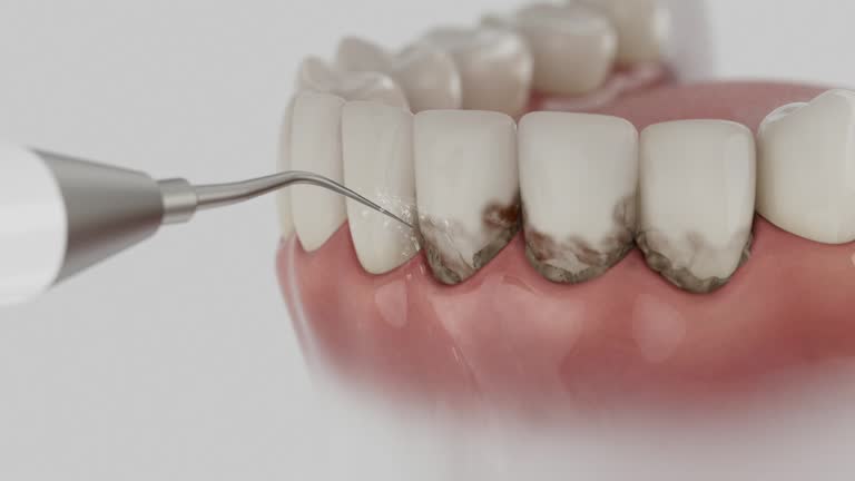 Reliable Dental Implants contractor in Stuart, VA by Smile Center Dentistry
